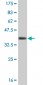 CDK4 Antibody (monoclonal) (M03)